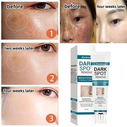 Zeg vaarwel tegen pigmentvlekken - en hallo tegen een egale, stralende huid