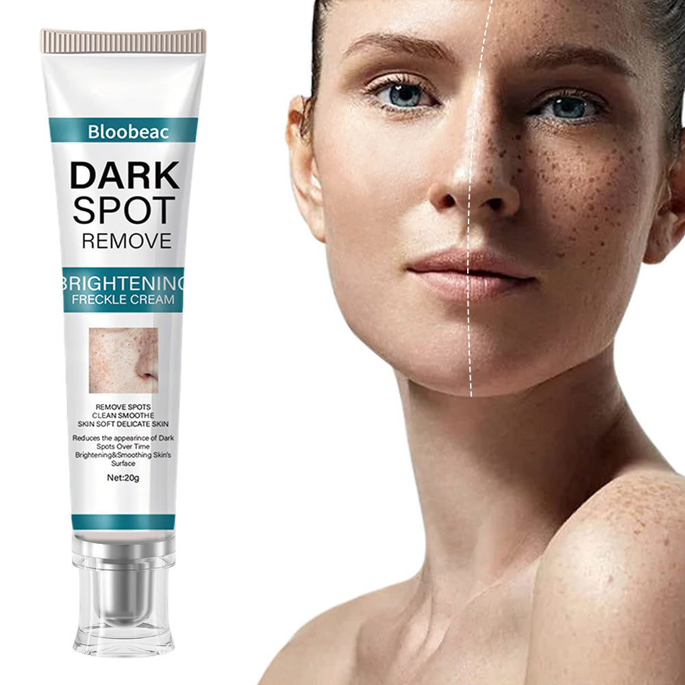 Zeg vaarwel tegen pigmentvlekken - en hallo tegen een egale, stralende huid