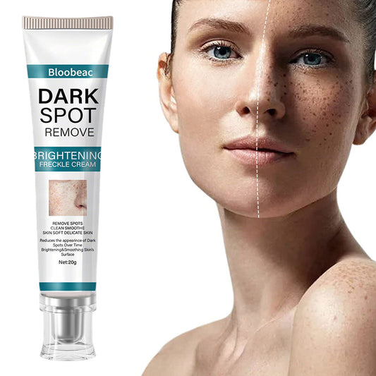 Zeg vaarwel tegen pigmentvlekken - en hallo tegen een egale, stralende huid