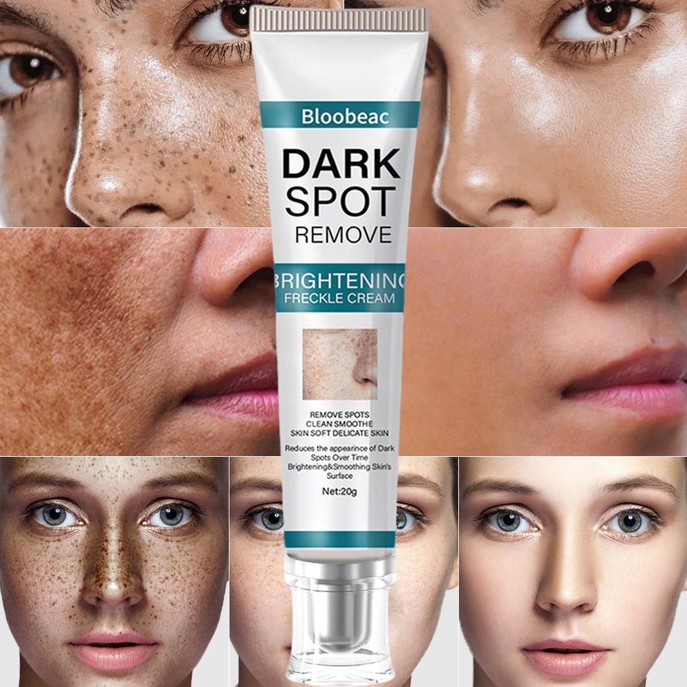 Zeg vaarwel tegen pigmentvlekken - en hallo tegen een egale, stralende huid