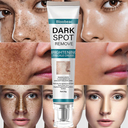 Zeg vaarwel tegen pigmentvlekken - en hallo tegen een egale, stralende huid