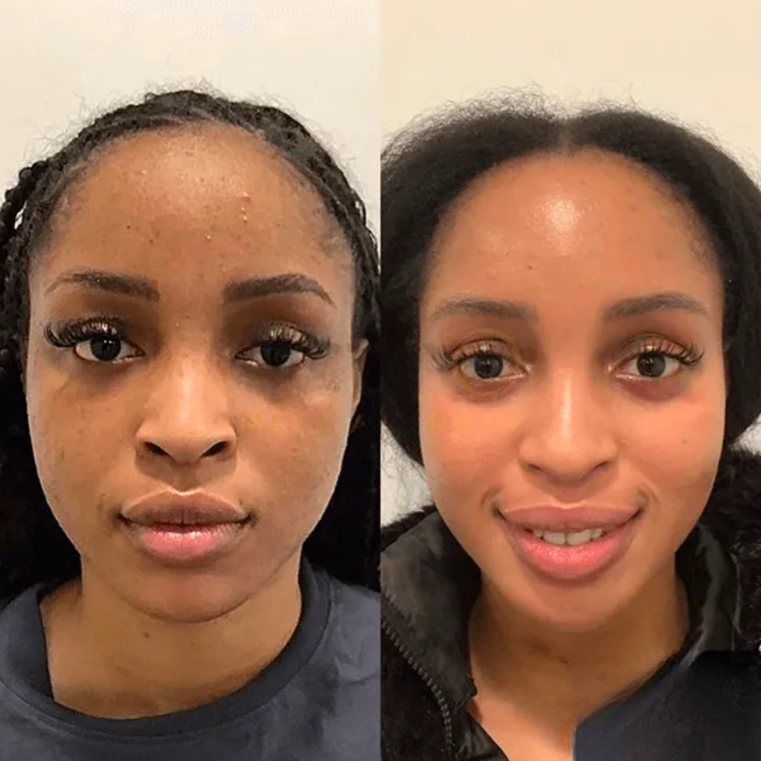 Collagen Night – Ontwaak met een volle, zijdezachte huid