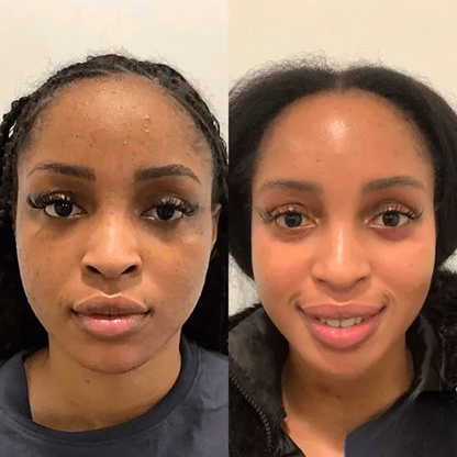 Collagen Night – Ontwaak met een volle, zijdezachte huid