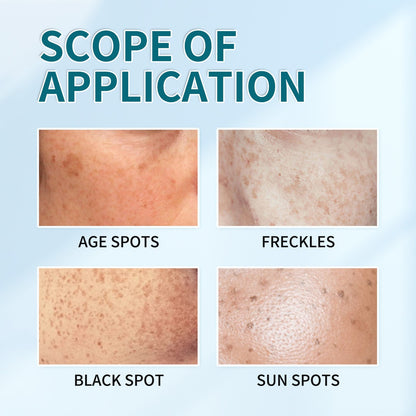 Zeg vaarwel tegen pigmentvlekken - en hallo tegen een egale, stralende huid