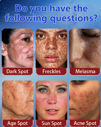 Zeg vaarwel tegen pigmentvlekken - en hallo tegen een egale, stralende huid